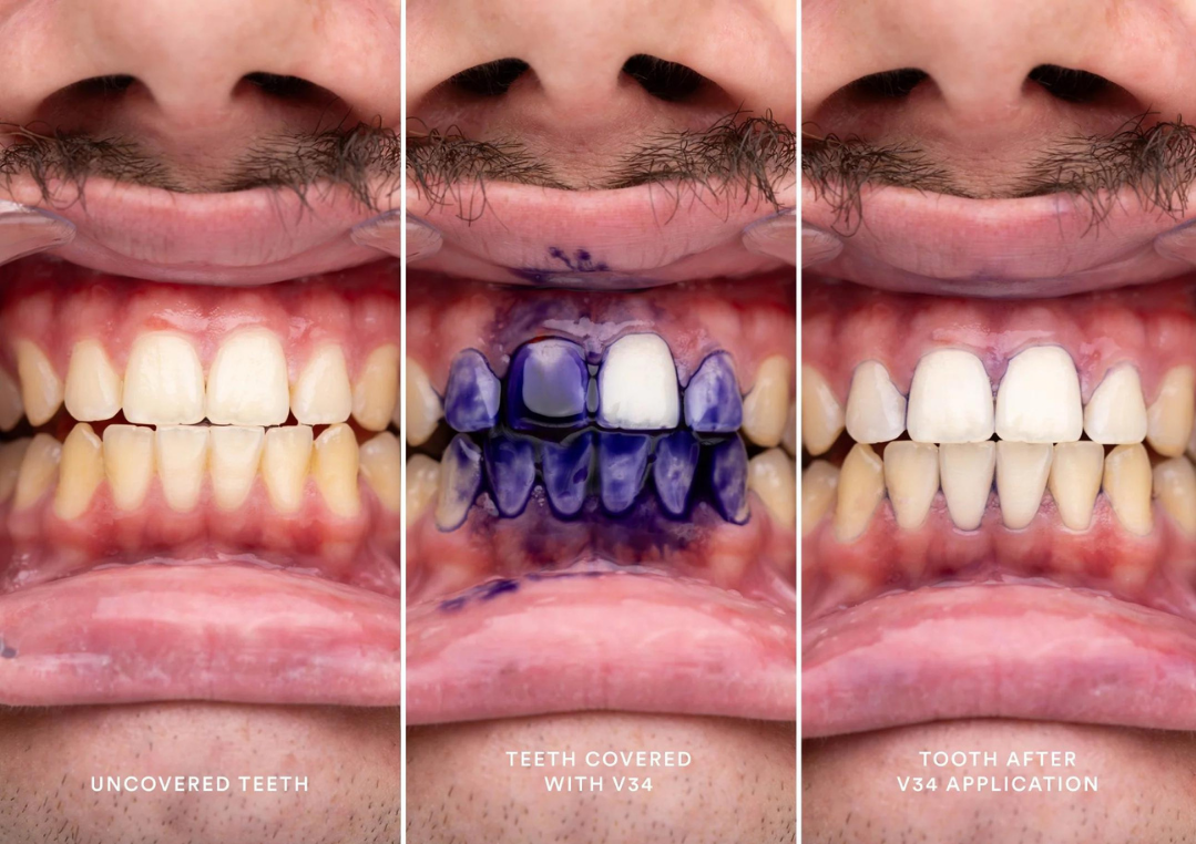 SmileSecret™