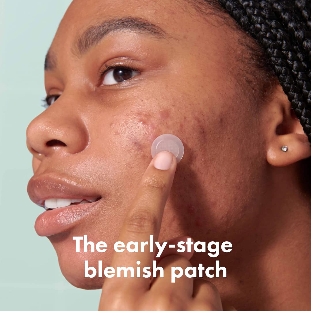 Micropoints Patches for Blemishes