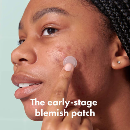Micropoints Patches for Blemishes